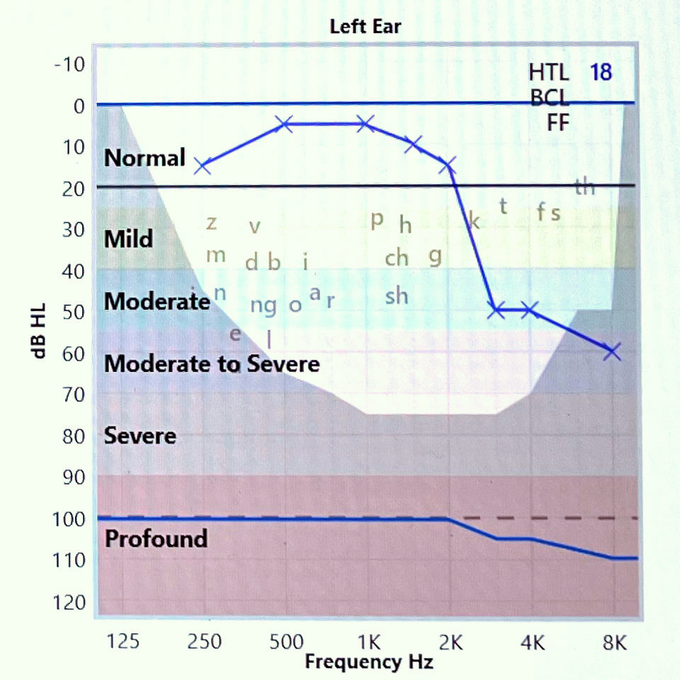 audiogram left ear